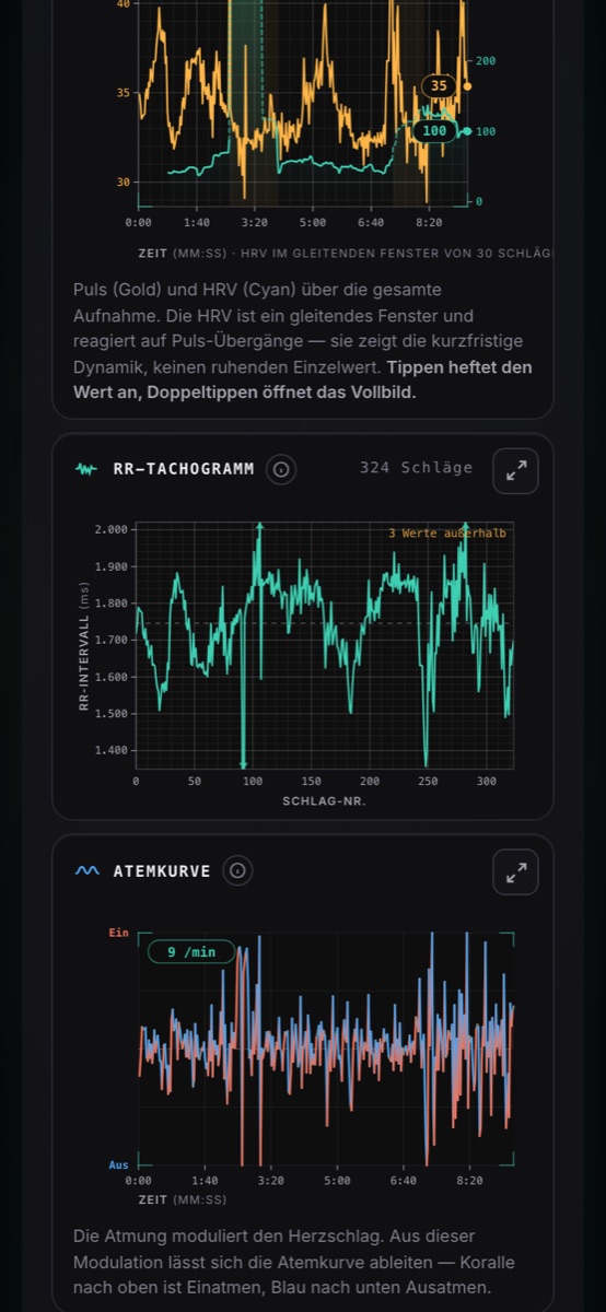 RR tachogram over 324 beats and below it the breathing curve derived from heartbeat modulation