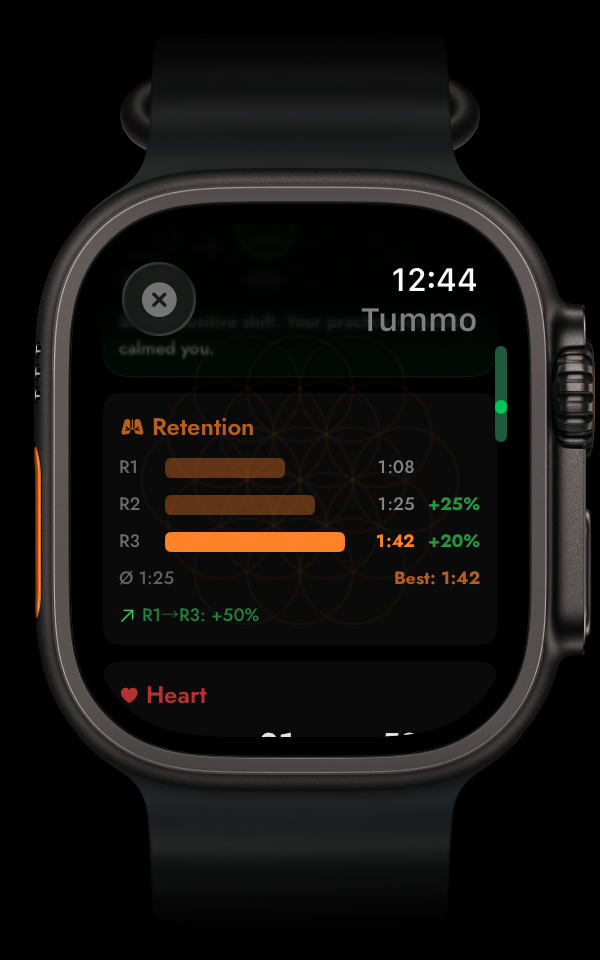 Watch — retention R1 to R3, improving +25%