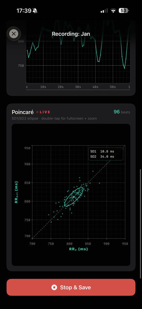 CARLON Research — live RR stream with Poincaré SD1/SD2